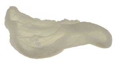 Upholstery assembly sock (000306)